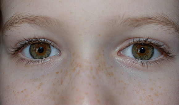 greg's eyes