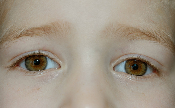 matthew's eyes